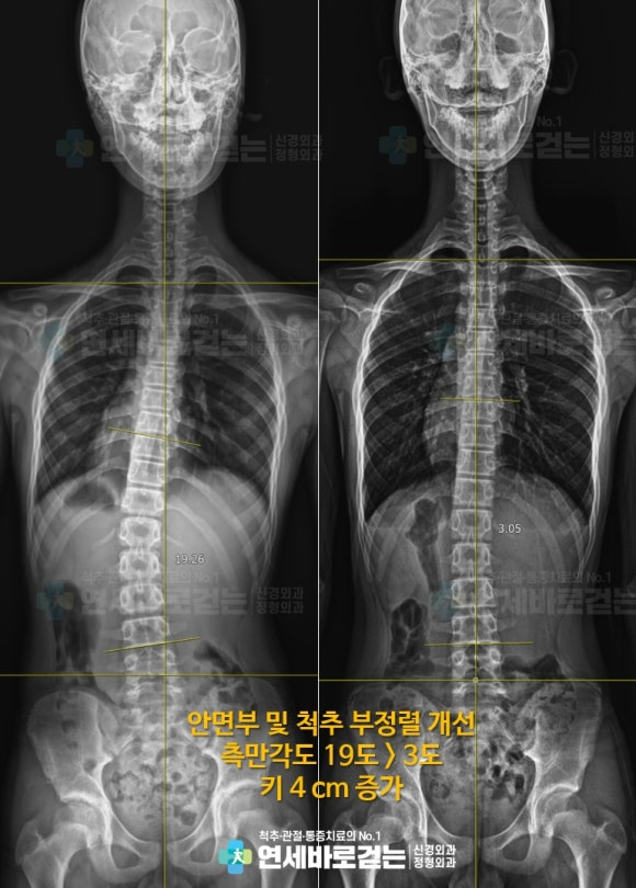 범계신경외과